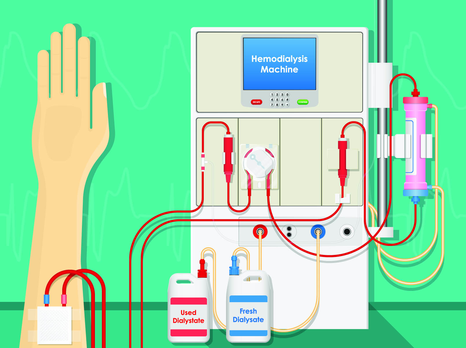 what-ails-our-kidneys-and-what-s-the-remedy