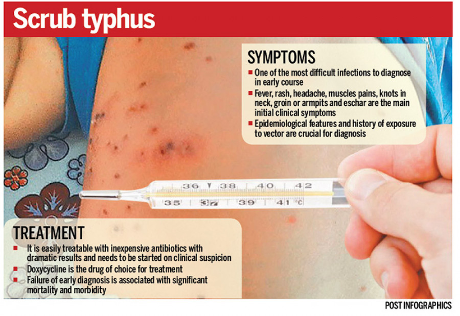 over-300-people-infected-with-scrub-typhus-in-20-districts