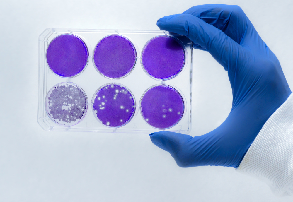 The threat of bioterrorism