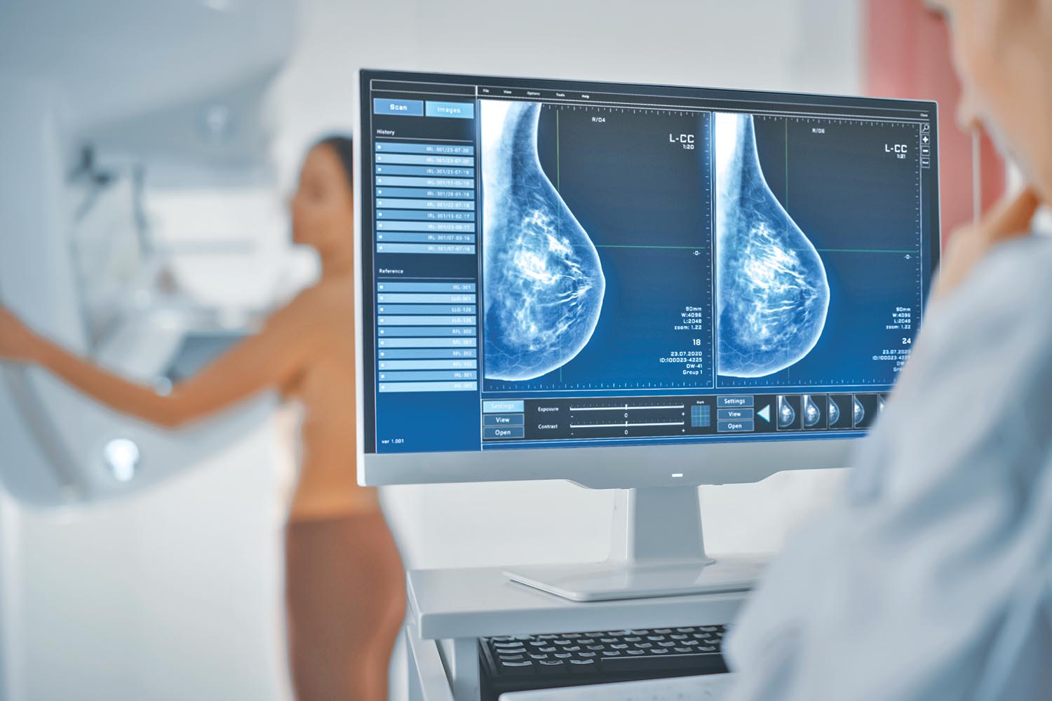NPHL starts next-generation sequencing for breast cancer