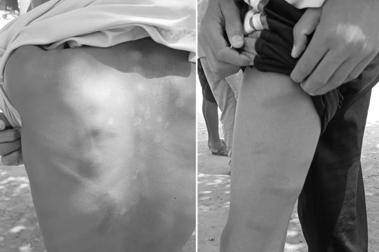teacher-detained-after-allegedly-beating-student