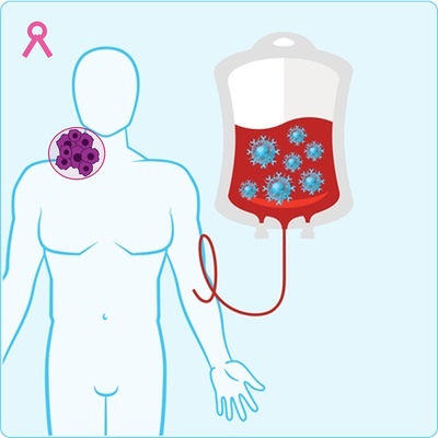 Nepal begins CAR T-cell therapy for cancer patients 